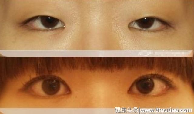 中国人身上的三大特殊印记，牙齿眼睛与众不同，实在是太神奇了！
