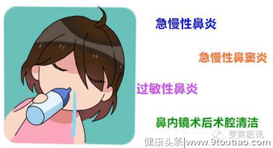 喷嚏、鼻痒、鼻塞、清水样涕，过敏性鼻炎可以这样选药