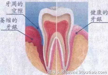 那些用了美牙仪的朋友都有什么下场？