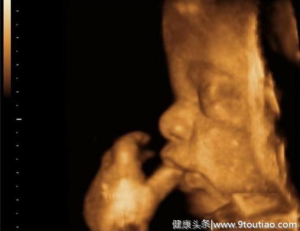 宝宝早在子宫里就会吸吮手指，被四维彩超悄悄拍下，妈妈该开心了