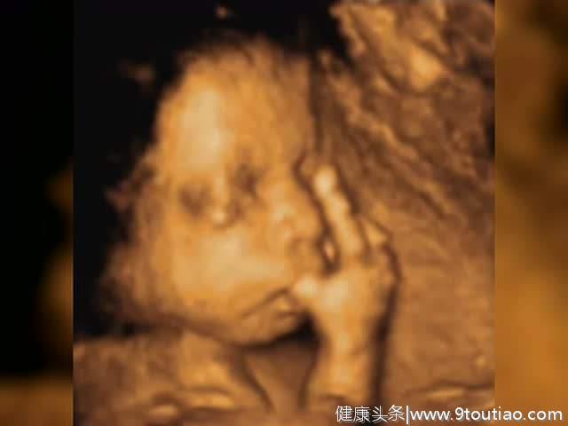 宝宝早在子宫里就会吸吮手指，被四维彩超悄悄拍下，妈妈该开心了