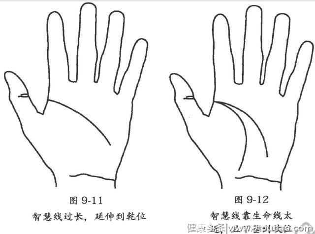 入睡困难、睡不踏实、多梦……不同类型的失眠，治疗办法