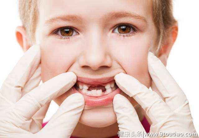 孩子有蛀牙？保护孩子口腔健康势在必行！