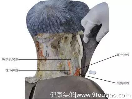 最新版头痛（颈源性头痛）中医诊疗方案