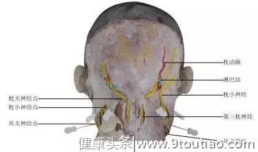 最新版头痛（颈源性头痛）中医诊疗方案