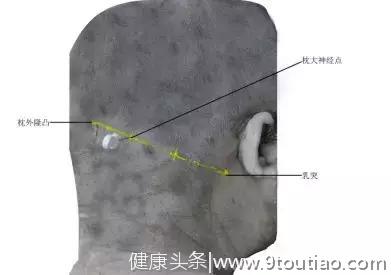 最新版头痛（颈源性头痛）中医诊疗方案