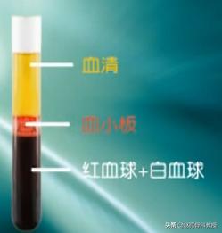 治疗骨关节炎方法很多种？你到底适合哪一种治疗方法？