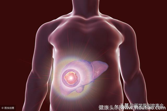 胸部出现一种痣的时候，最好去检查一下肝脏，肝癌可能已经来临
