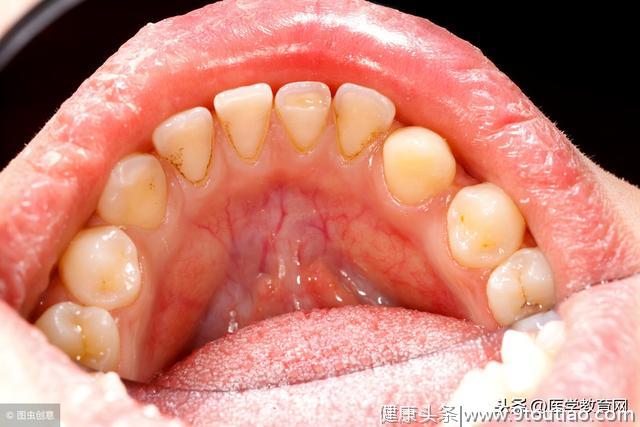 医生说 | 你的口腔里细菌多吗？你选择牙膏适合你吗?