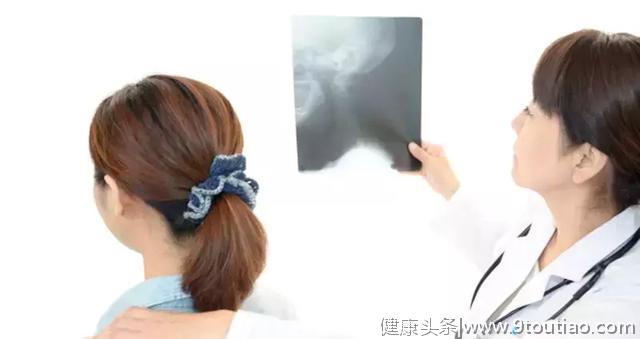 在日本，颈椎椎间盘突出不一定非得做“金属融合术”