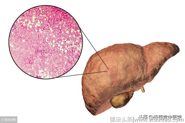 不只肥胖，缺乏蛋白质也会有脂肪肝？中医揭7大高风险族群！