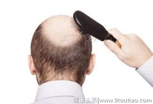 脱发怎么办？专家建议：最有益头发生长的5种食物