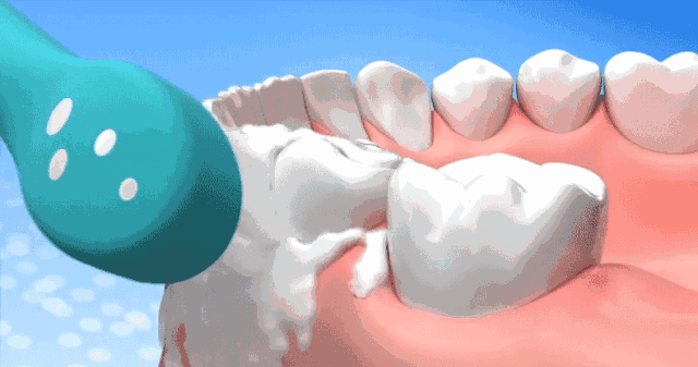您的牙龈还好吗？就是因为你干了这些事，才导致的牙龈萎缩！