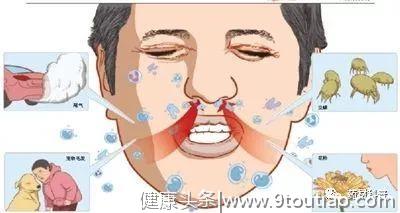 这几种治疗过敏性鼻炎的中药，你知道几个？