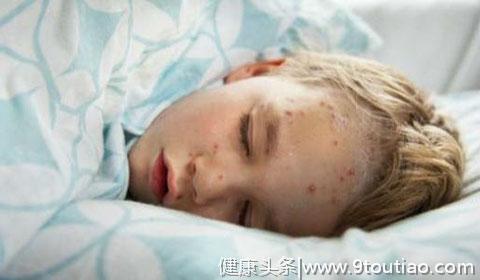 连云港市疾控中心提醒：猩红热发病上升，家长孩子注意防控