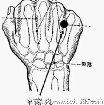 缓解膝关节疼痛，老中医私藏的“指压穴位治疗”口诀，在这里！
