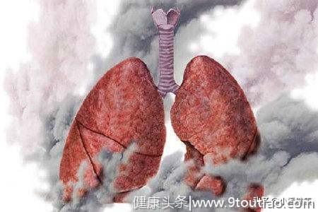 轻中度慢阻肺应增加肺癌筛查！