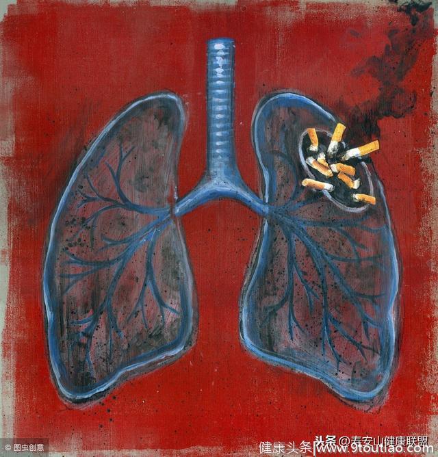怀疑肺癌？超强肺癌科普来啦！