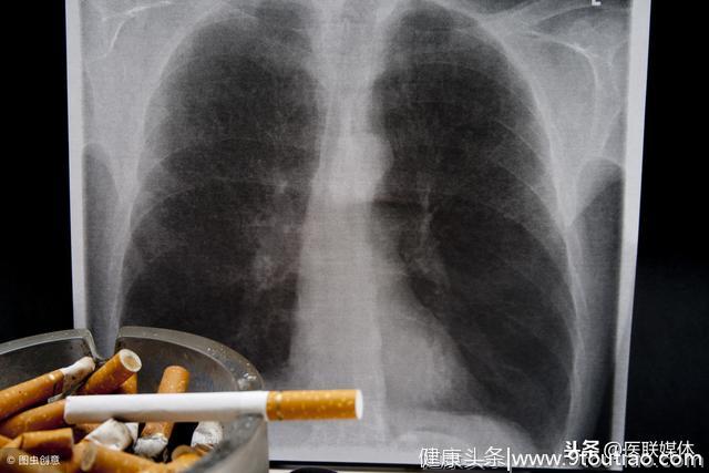 肺癌出现咳血，大概是到了什么阶段？医生：靠这一检查诊断