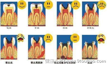 不要轻易拔牙，不然真的会后悔