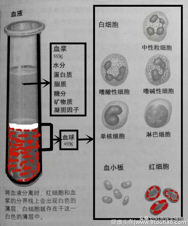长文干货:血液科医生实拍白血病细胞，详解白血病的用药和治疗~