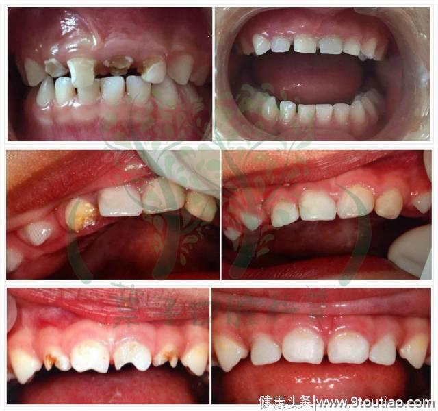 经验分享：全科牙医的儿牙学习之路#葉子口腔科普#