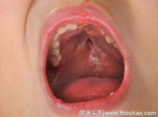 “口臭”未必是口腔问题，伴随出现这4种情况，最好检查一下胃