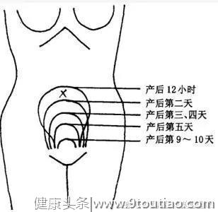 如果产后子宫复旧不良，会带来哪些隐患呢？