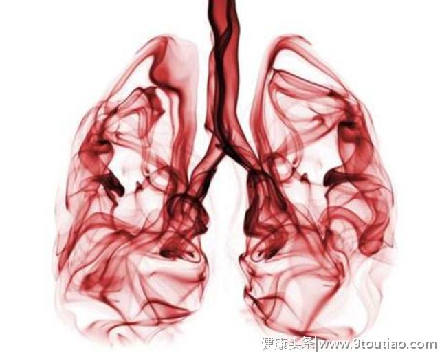 湖南每4个新发癌症患者，就有1个肺癌，肺癌高危因素有哪些？