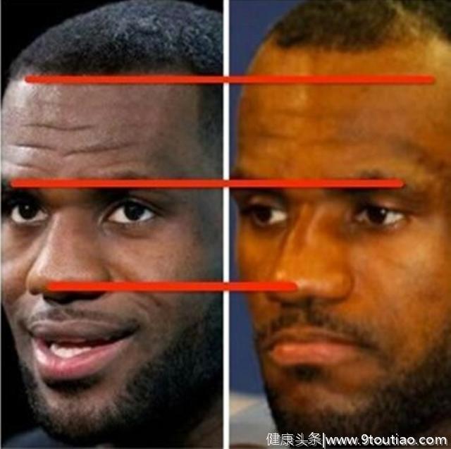 打球会脱发？NBA3大巨星的脱发之路：一图看詹姆斯发际线的变化 