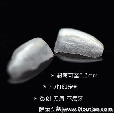 明星一口闪亮的大白牙，到底用了什么方法？