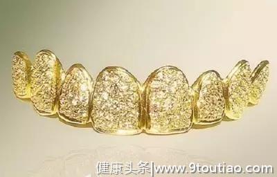 世界牙科趣闻！黄金和钻石打造假牙......