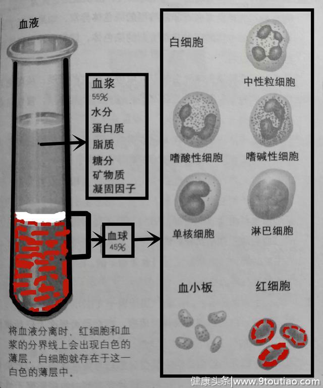 长文干货|为什么白血病的人每天要输那么多的血浆和血小板？