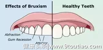 磨牙是因为肚子里有蛔虫？真正原因其实在这里……