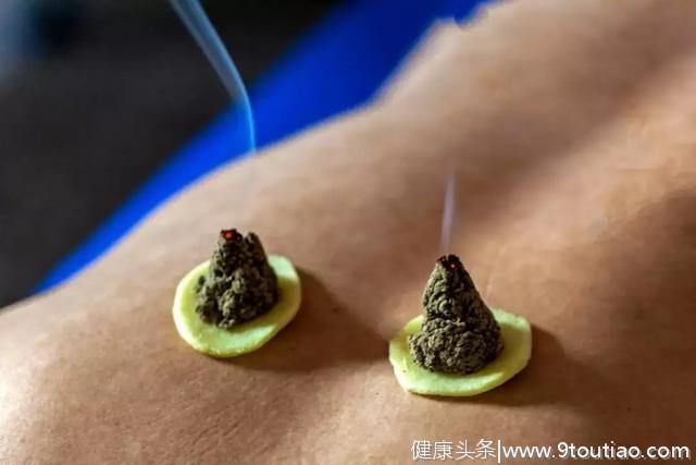 中国中医科学院：艾灸的最佳时间和顺序 一篇文章全看懂
