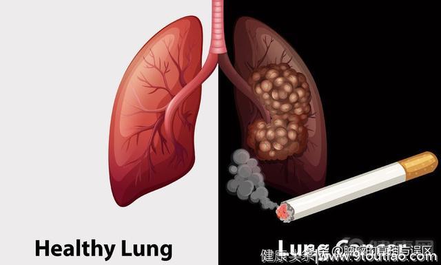 肺癌诱因有4个，虽然不吸烟，但也不代表你很安全