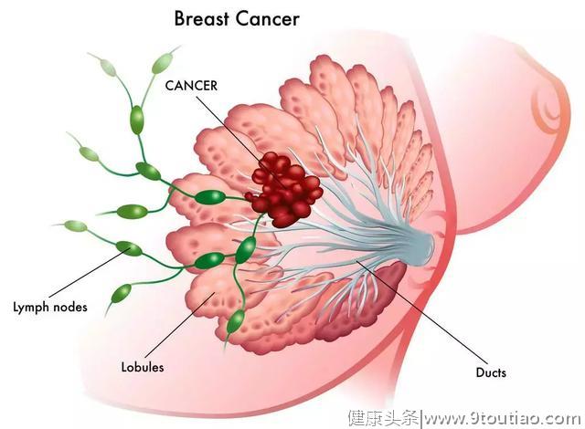 晚婚晚育、频繁做人流手术……这样的你，乳腺癌表示有点稀罕……