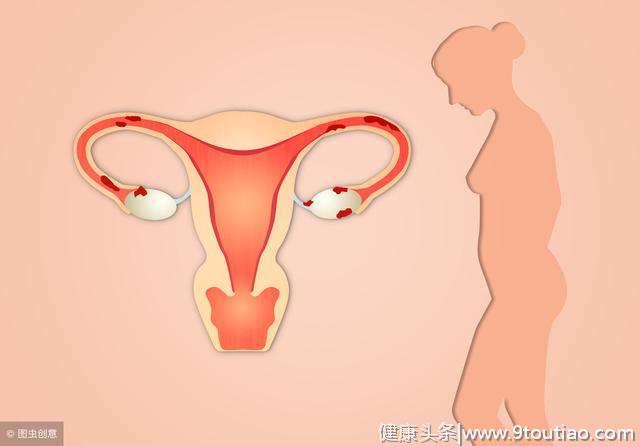 子宫肌瘤导致不规则出血主要有以下六种情况