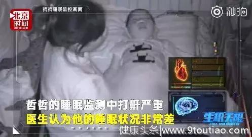 OSAHS被忽视的睡眠“杀手”，宝宝鼻炎、中耳炎、变丑都跟TA有关