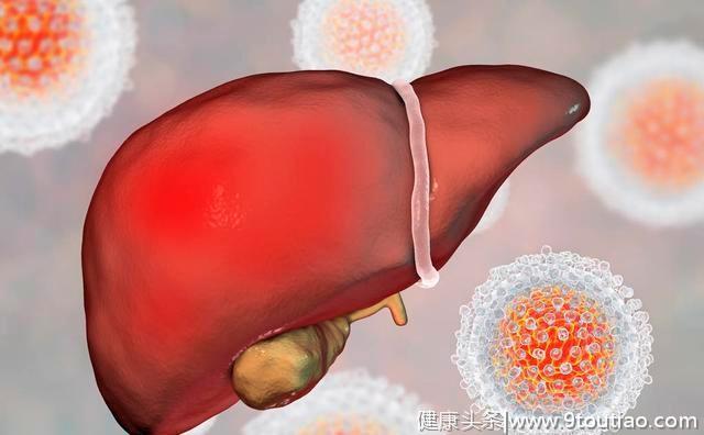 肝硬化是乙肝的必然结果吗？