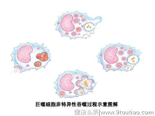 骨关节炎只能换人工关节？这种治疗方法改善炎症没有副作用。