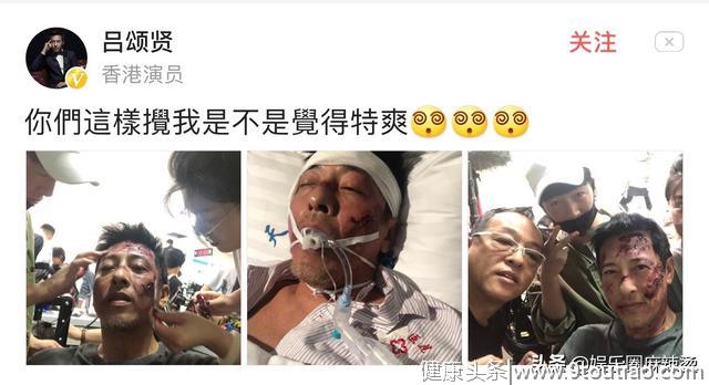 港星吕颂贤曝“医院急救”照片，口腔塞满了吸氧气管，吓坏了网友