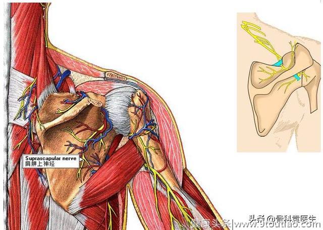 骨科医生：肩周炎就是这2块肌肉，1根神经有了问题导致的