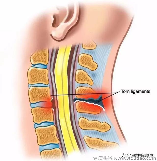 如果你认为瑜伽就是拉韧带，那你就错了！