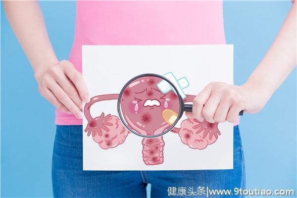 妇科名医李红霞：子宫肌瘤，必须“一刀切”吗？