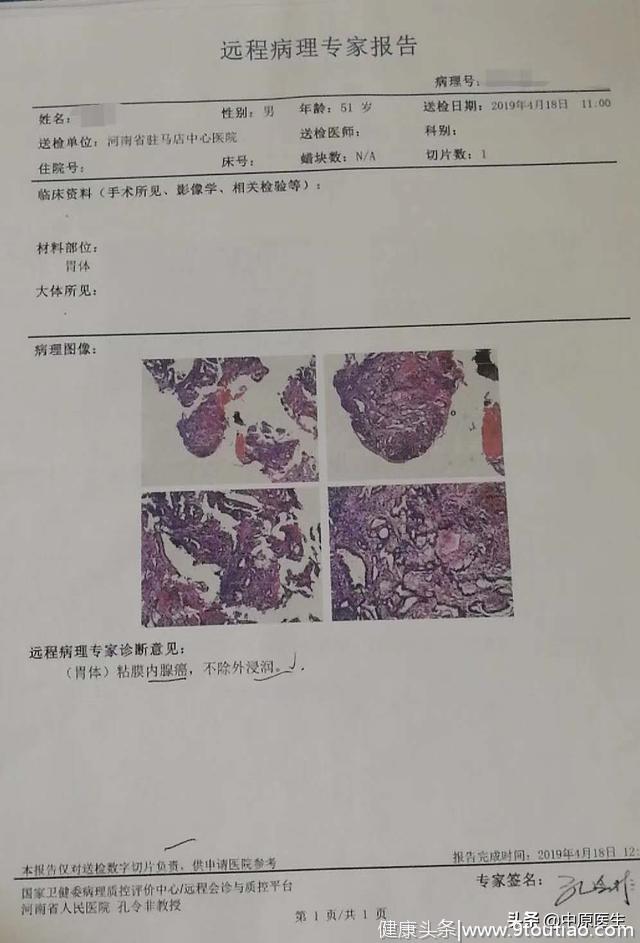 男子腹胀怕做胃镜，被查出胃癌