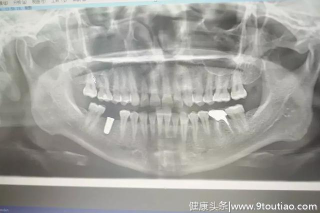 从业18年的牙医告诉你：中国的儿童齿科有多黑？