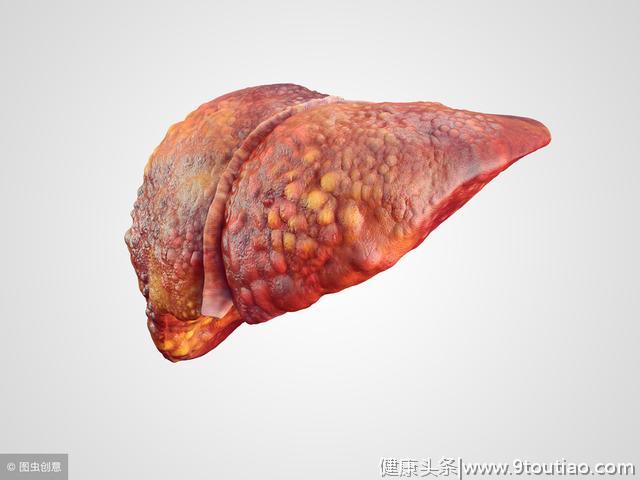 乙肝是肝癌的"敲门砖"，这种元素要多补，阻止病毒复制防肝癌