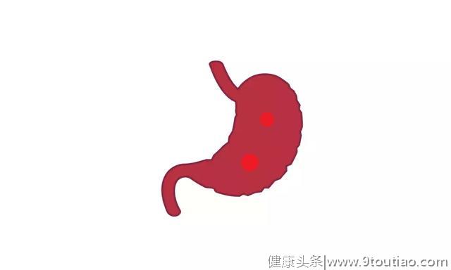 幽门螺旋杆菌会引发胃癌，它在胃里是如此作妖的！