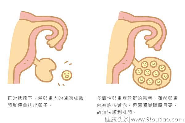 月经不调莫忽视，健康食疗妳要知！